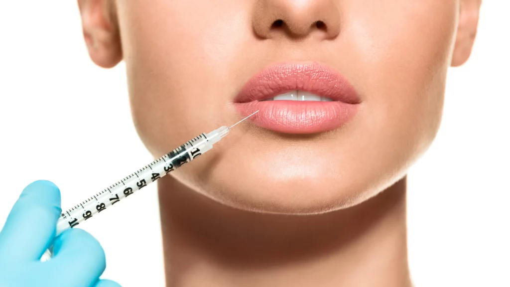 Tratamientos de Ácido Hialurónico en Marbella | Art Clinic Medicina Estética